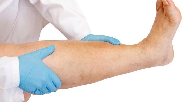 jak rozpoznać chorobę